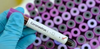 424 novih pozitivnih na korona virus, preminulo još pet osoba