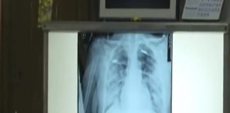 U poslednja 24 sata 102 nova slučaja zaraženih virusom korona