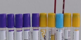 PCR testovi obavezni za građane Hrvatske, Severne Makedonije, Bugarske i Rumunije