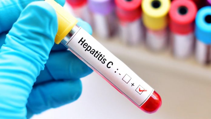 Hepatitis