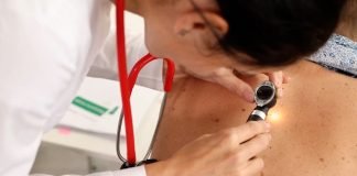 Melanom – Genetsko nasleđe veći faktor
