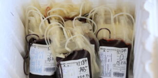 Institut za transfuziju – Rezerve krvi u Srbiji na minimumu