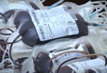 Smanjene rezerve krvi, neke grupe na minimumu