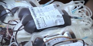 Smanjene rezerve krvi, neke grupe na minimumu